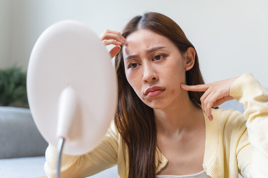 Asian young woman worry about acne on her face after wear face mask.