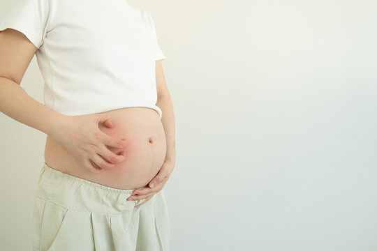 Pregnant woman scratched her belly because of itchy skin. Belly itching during pregnancy can be caused by skin stretching, dry skin, or other health conditions.