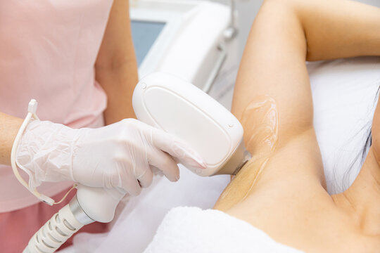 Female technician performs laser hair removal treatment on a woman's underarm in a modern beauty clinic with advanced equipment visible in the background. Diode laser epilation hair removal procedure