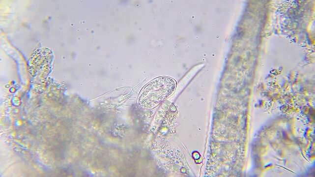 Microscopic view of a single nematode egg in a water sample under 400x brightfield magnification