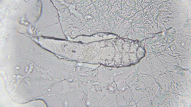 Demodex brevis mite embedded in skin tissue under 400x brightfield magnification microscope