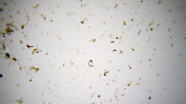 Nematode roundworm moving in a clear water droplet under 40x brightfield magnification