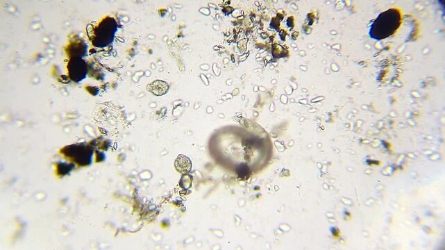 Active nematode roundworm with internal eggs under 100x brightfield magnification microscope