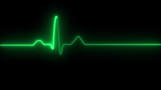 Heart Rate Monitor Electrocardiogram Ekg Or Ecg Looping background. animated normal sinus rhythm. animated ekg display