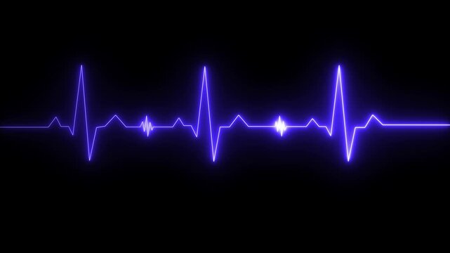 EKG 60 BPM Loop Screen, Red w/ Grid. Heart rate monitor / electrocardiogram (EKG or ECG) loop beeping at 60 beats per minute for screen savers or computer monitor displays,