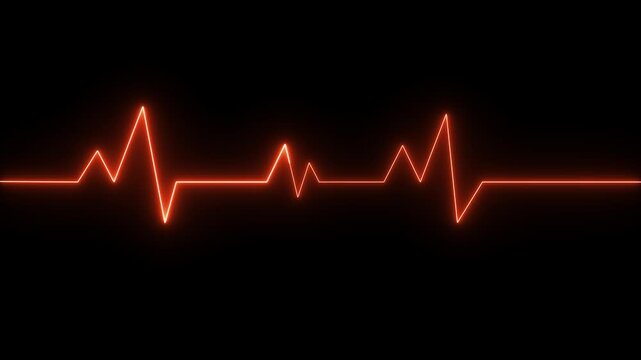 Cardiogram cardiograph oscilloscope screen. EKG 002: An electrocardiogram heart monitor pulses on a blue grid (Loop)