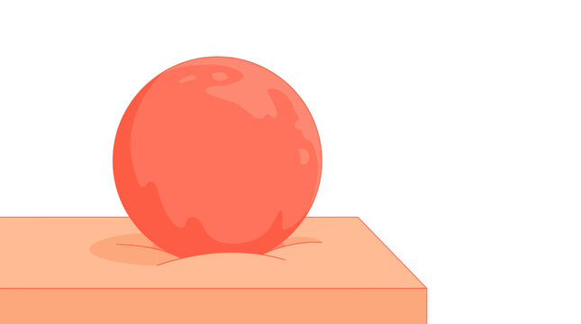 Medical Illustration of Red Inflamed Pimple or Cyst on Human Skin