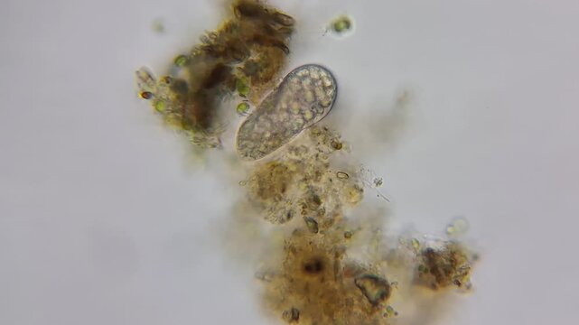 Microscopic view of a living ciliate protist moving near organic debris
