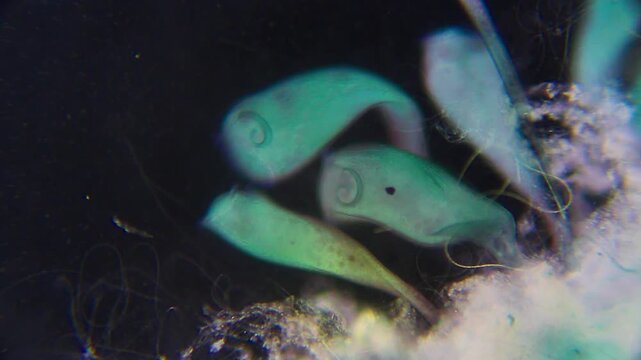 Vibrant Stentor ciliates attached to substrate filter feeding under 100x darkfield magnification microscope