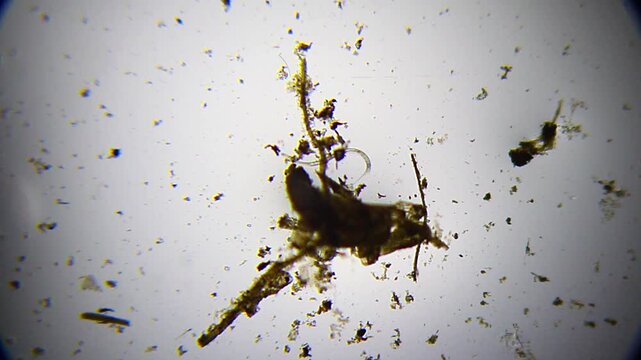 Single nematode roundworm hidden in organic substrate under 40x brightfield magnification
