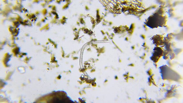 Single sluggish nematode worm among organic debris under 100x brightfield magnification microscope