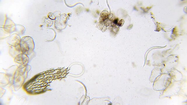 Small nematode roundworms swimming among organic debris under 100x brightfield magnification