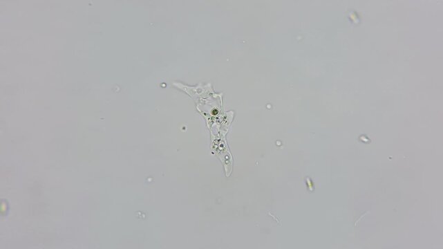 Real microphotography of living amoeba moving under microscope, scientific background