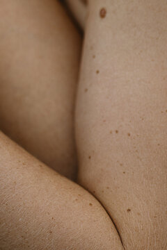 Close up photo of woman's skin texture of the arm with moles