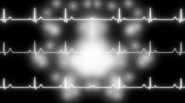 Medical Heartbeat Monitor Rhythm Patterns.