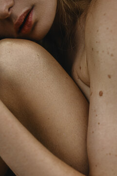 Close up photo of woman's skin texture of the lips with moles