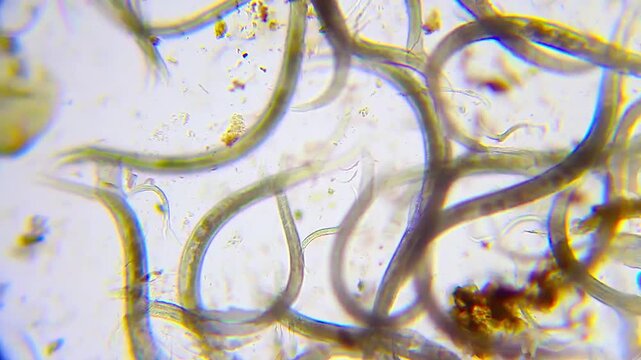 Selective focus of a single nematode roundworm near a blurred cluster under 100x brightfield