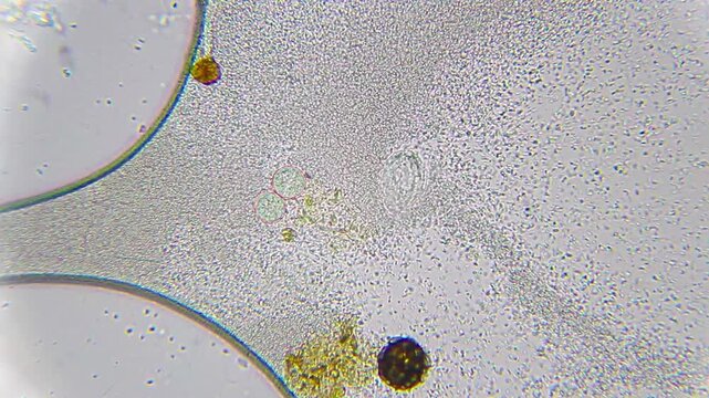 Microscopic view of ciliate cysts and active protozoa among dense bacteria under 400x brightfield
