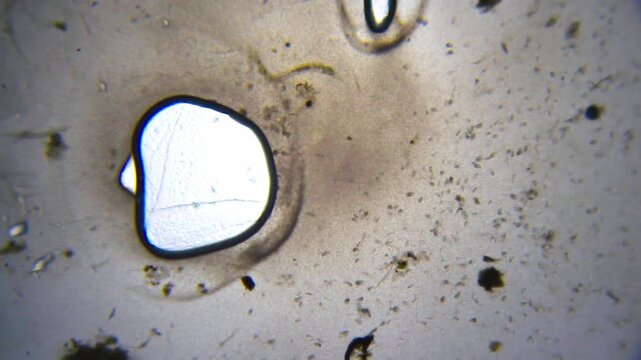 Microscopic view of dense live bacteria population and swimming ciliates under 40x brightfield