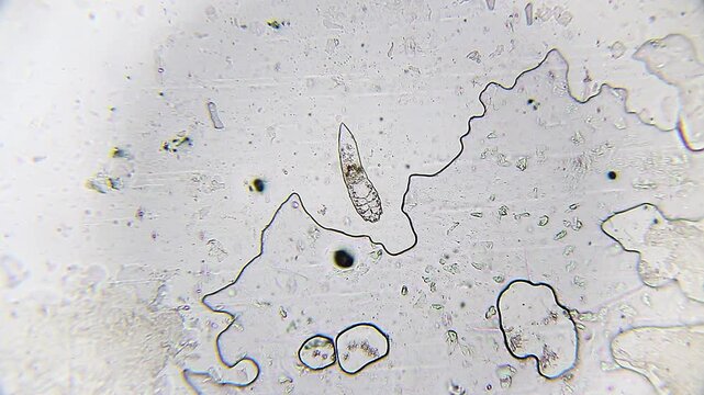Demodex brevis face mite under 100x brightfield microscopy magnification