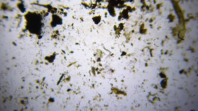 Small nematode roundworm in a drop of dirty water under 40x brightfield microscopy magnification