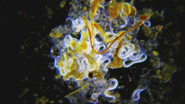 Cluster of nematode roundworms moving like snakes under 40x darkfield microscopy magnification