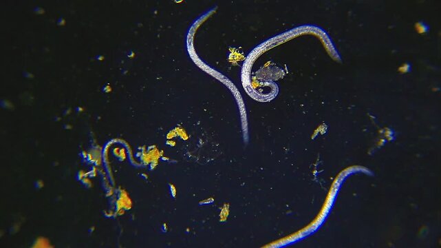 Nematode roundworms moving slowly in dirty water under 40x darkfield microscopy magnification