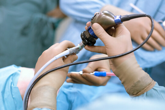 Surgeons with endoscopic camera during an operation