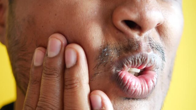 Young man experiencing intense toothache holding his cheek in pain while grimacing and showing teeth