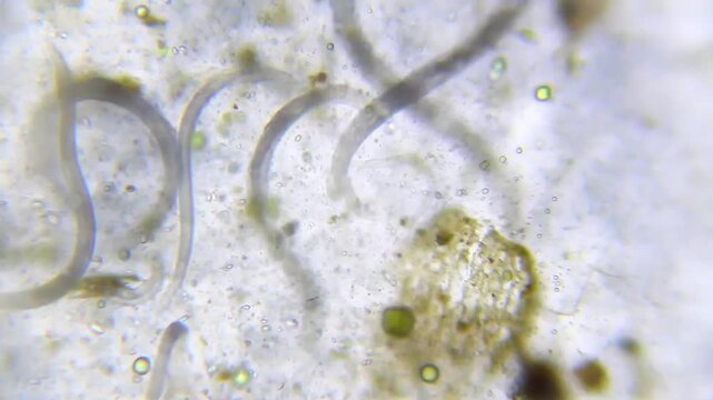 Nematode roundworms in ginger root juice with visible small starch particles and oil under 100x brightfield microscopy magnification