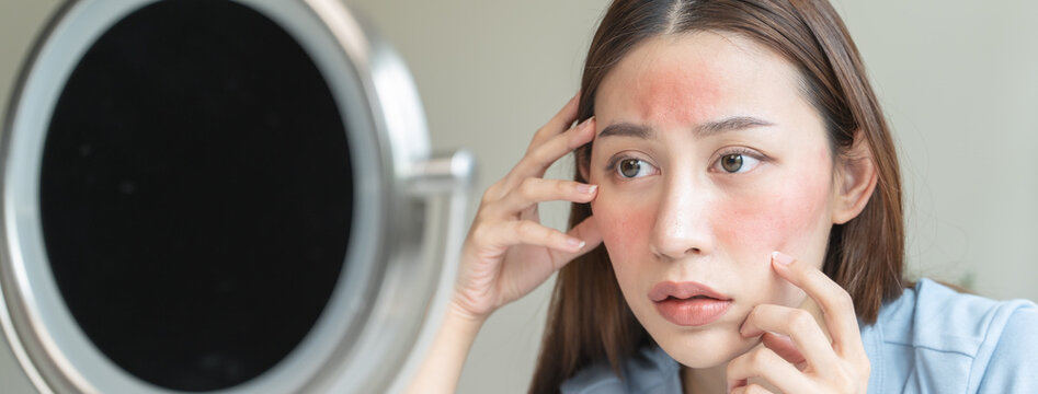 Sensitive skin with cosmetology, Asian young woman looking at red spot on her face from cosmetic allergy in the mirror.