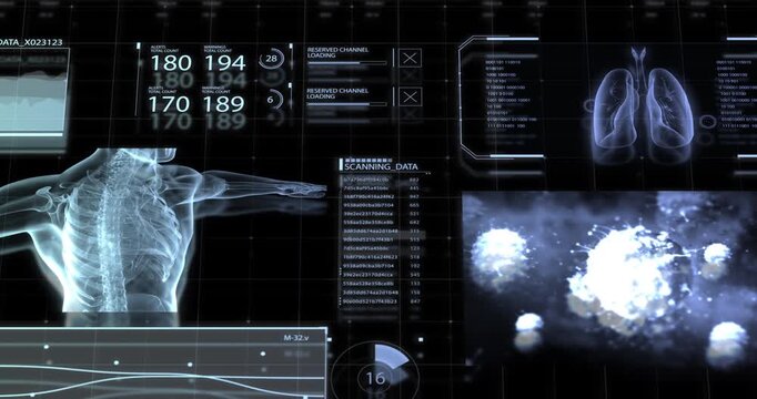 A detailed medical control screen shows an x-ray of a human spine, lung imagery, scanning data, and alert counters.