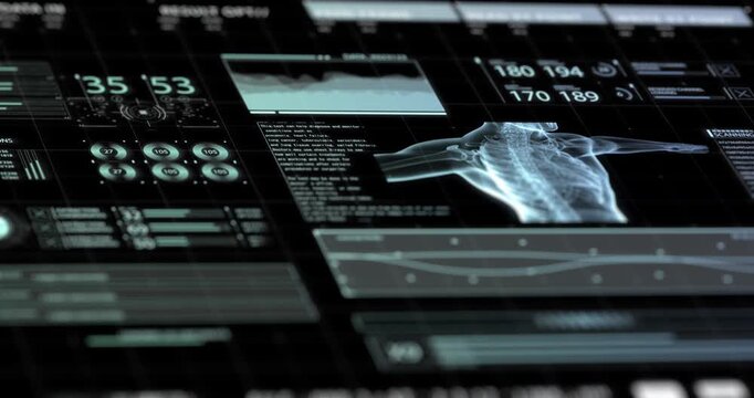 A futuristic medical interface displays a glowing x-ray scan of a human torso alongside charts, counters, and streaming data.