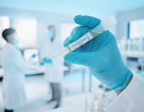 Scientist in blue gloves holds a Hantavirus IgM IgG test tube for analysis in a bright medical laboratory environment with researchers working