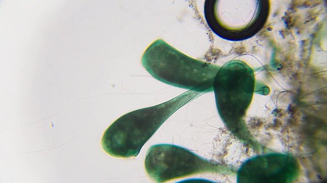 Stentor ciliates attached to substrate hunting and feeding on bacteria under 100x brightfield microscopy magnification