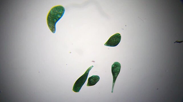 Group of Stentor ciliates swimming together under 40x brightfield microscopy magnification