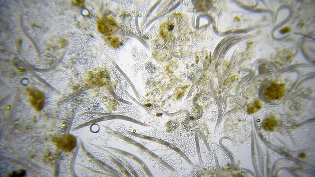 Massive cluster of non-moving nematode roundworms in a drop of dirty water under 40x brightfield microscopy magnification