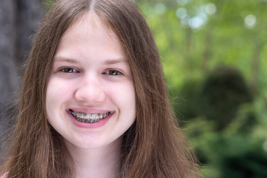 Portrait of happy caucasian teenage girl with metal dental braces on green nature background. Smiling teen with bracket outdoors. Teeth health care, orthodontic treatment concept. Copy space