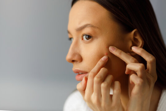 Young woman looks and touches acne pimples on her face skin. Teenage pustule pimply skin on the face. Portrait of a girl removing furuncle pustules in the bathroom.