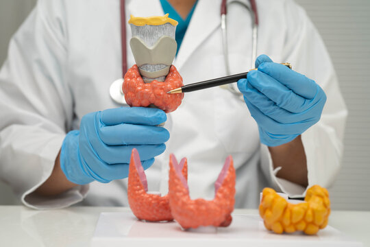 Hyperthyroidism, Overactive Thyroid, Thyroid Lymphoma, Asian doctor with thyroid gland human anatomy model in hospital.
