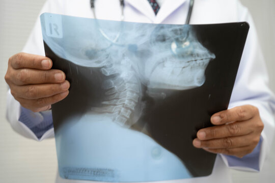 Doctor examining cervical vertebrae bone radiography xray film.