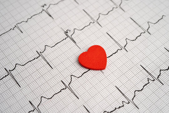 Electrocardiogram ECG, heart wave, heart attack, cardiogram report.