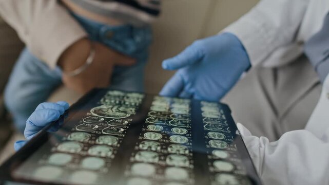 Unrecognizable doctor wearing blue gloves pointing at brain MRI scans on tablet screen during patient consultation. Video is perfect for neurology clinics and medical technology promotions