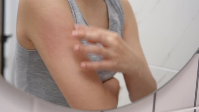 skin problem and beauty. woman scratch body has itchy skin from skin allergic, steroid allergy, sensitive skin, red from sunburn, chemical allergy, rash, insect bites, Seborrheic Dermatitis.