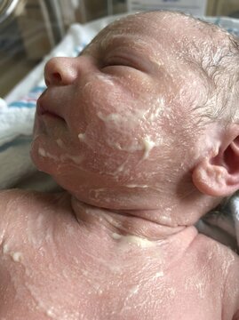Newborn Baby Close-Up Face with Vernix Caseosa Skin Right After Birth, Hospital Delivery Room