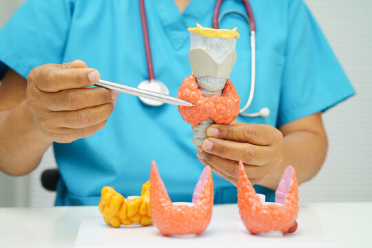 Hyperthyroidism, Overactive Thyroid, Thyroid Lymphoma, Asian doctor with thyroid gland human anatomy model in hospital.
