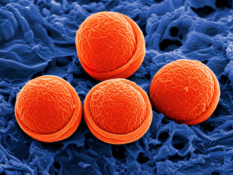 Scanning Electron Micrograph Of Orange Spherical Bacteria On A Blue Textured Surface