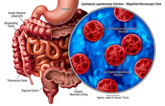 Medical Illustration Showing Human Digestive Anatomy With Microscopic View Of Cyclospora Oocysts