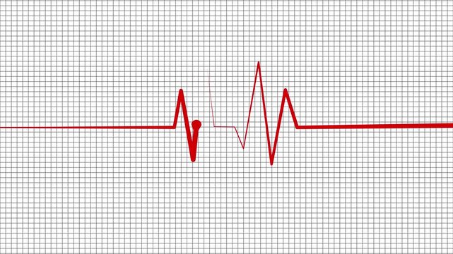 Heartbeat line on grid background animation