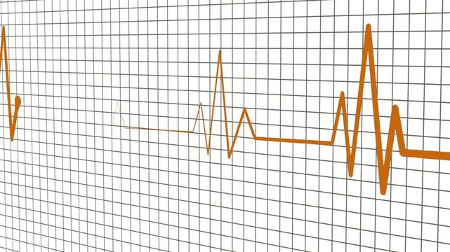 Ecg heartbeat line on grid background animation